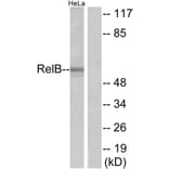 Western Blot - Anti-RelB Antibody (B7212) - Antibodies.com