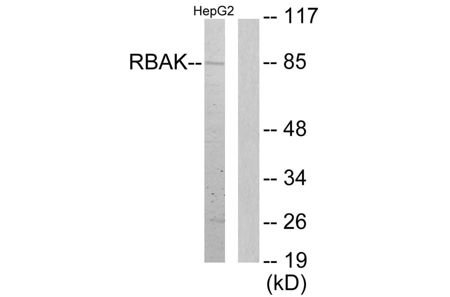Western Blot - Anti-RBAK Antibody (C11784) - Antibodies.com
