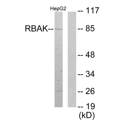 Western Blot - Anti-RBAK Antibody (C11784) - Antibodies.com