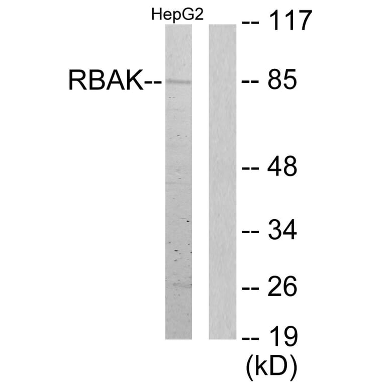 Western Blot - Anti-RBAK Antibody (C11784) - Antibodies.com