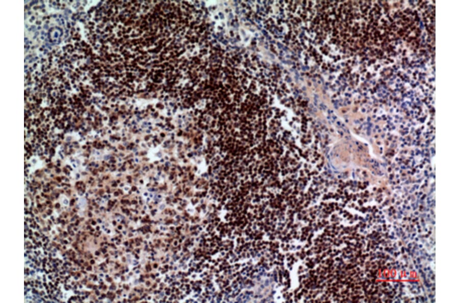 Immunohistochemistry - Anti-PAX5 Antibody (C30750) - Antibodies.com