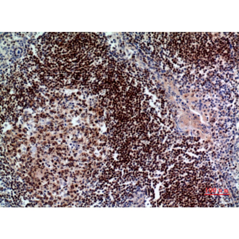 Immunohistochemistry - Anti-PAX5 Antibody (C30750) - Antibodies.com