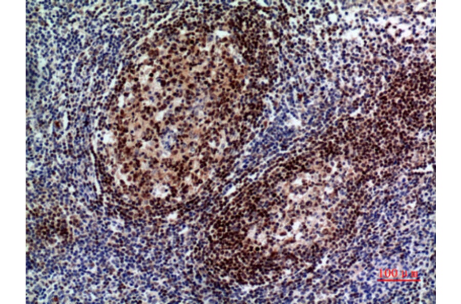 Immunohistochemistry - Anti-PAX5 Antibody (C30750) - Antibodies.com