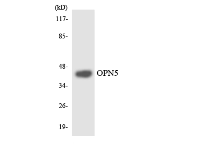 Western Blot - Anti-OPN5 Antibody (R12-3121) - Antibodies.com