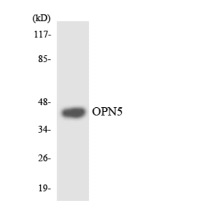 Western Blot - Anti-OPN5 Antibody (R12-3121) - Antibodies.com