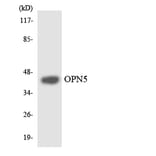 Western Blot - Anti-OPN5 Antibody (R12-3121) - Antibodies.com