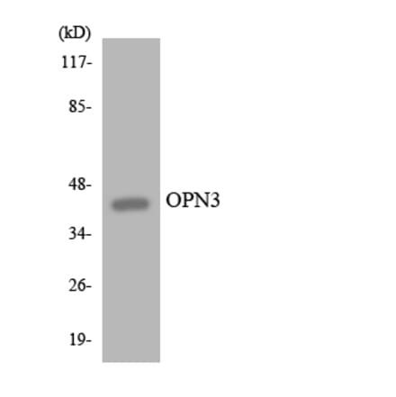 Western Blot - Anti-OPN3 Antibody (R12-3119) - Antibodies.com