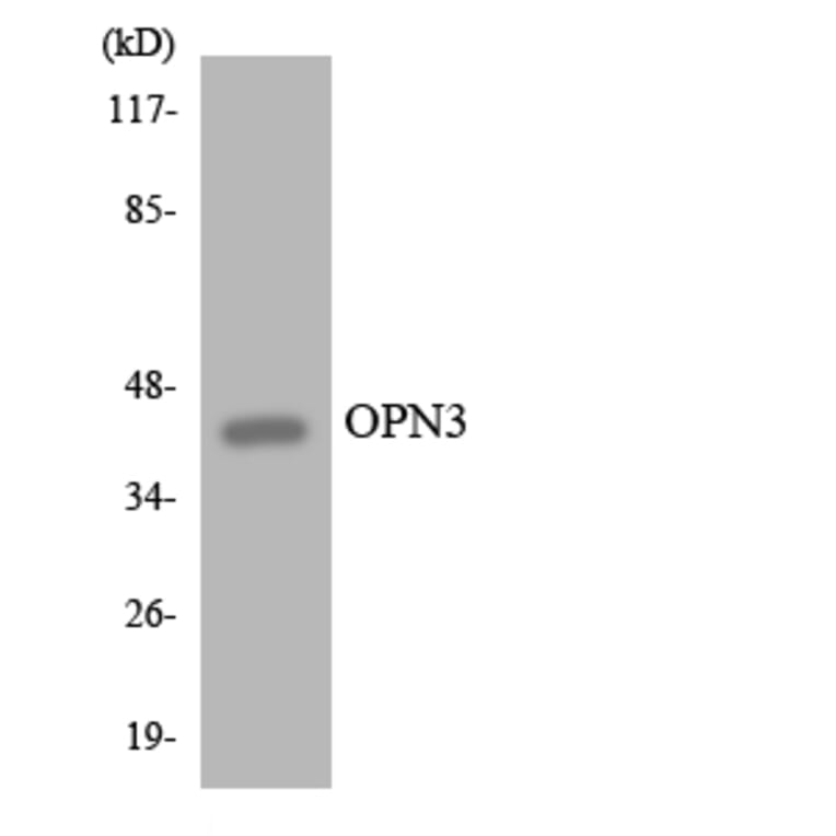 Western Blot - Anti-OPN3 Antibody (R12-3119) - Antibodies.com