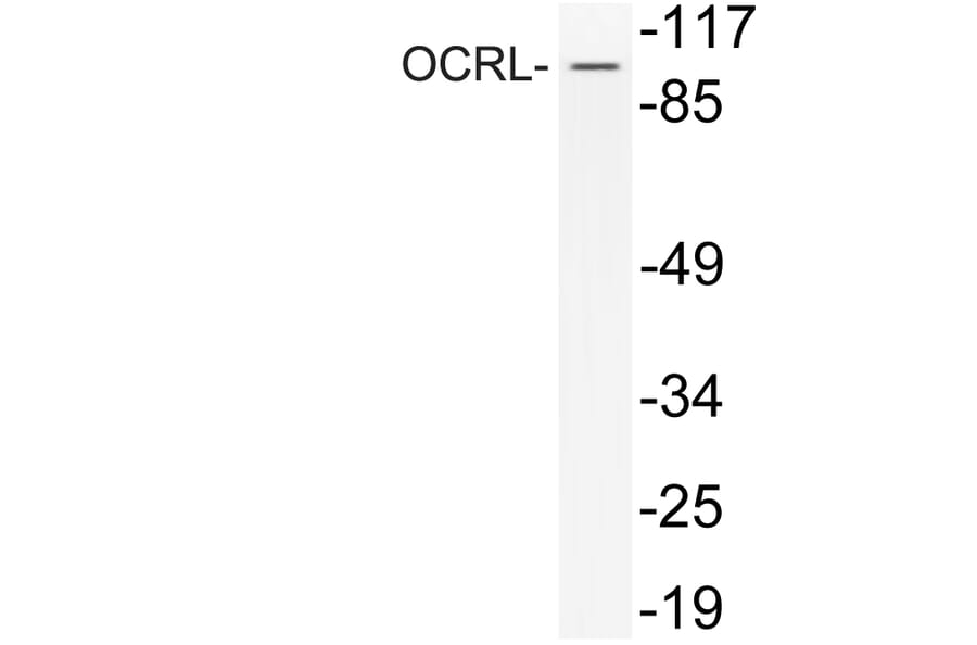Western Blot - Anti-OCRL Antibody (R12-2281) - Antibodies.com