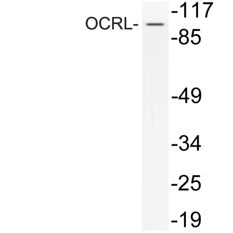 Western Blot - Anti-OCRL Antibody (R12-2281) - Antibodies.com