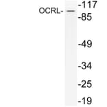Western Blot - Anti-OCRL Antibody (R12-2281) - Antibodies.com