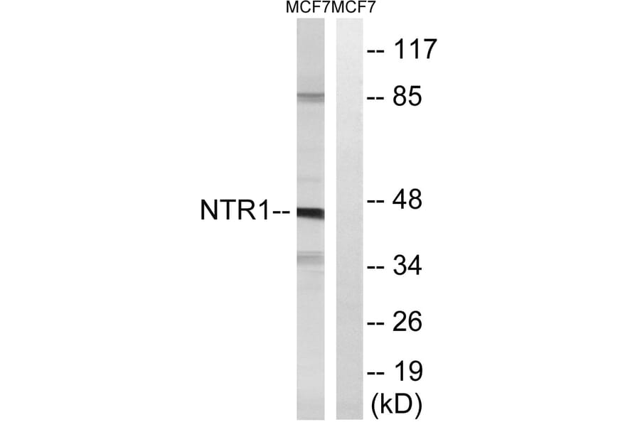 Western Blot - Anti-NTR1 Antibody (G413) - Antibodies.com