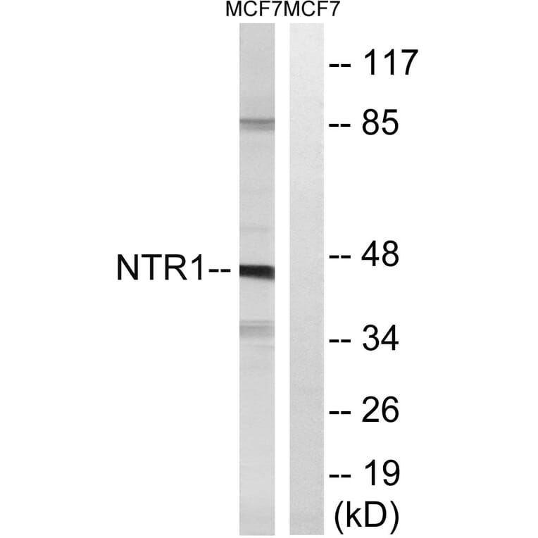 Western Blot - Anti-NTR1 Antibody (G413) - Antibodies.com