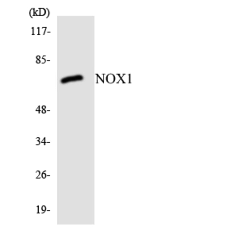 Western Blot - Anti-NOX1 Antibody (R12-3099) - Antibodies.com