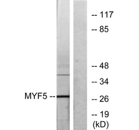 Western Blot - Anti-MYF5 Antibody (C10359) - Antibodies.com