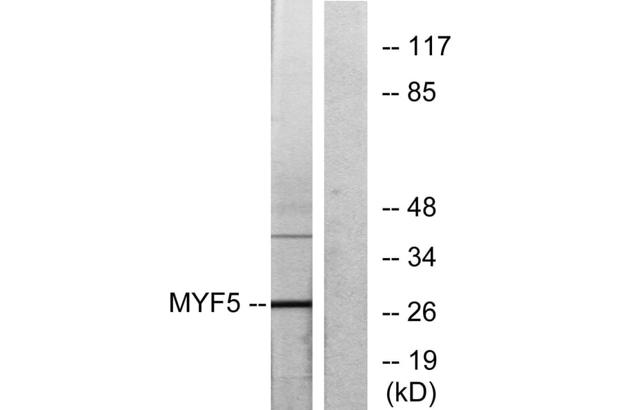 Western Blot - Anti-MYF5 Antibody (C10359) - Antibodies.com