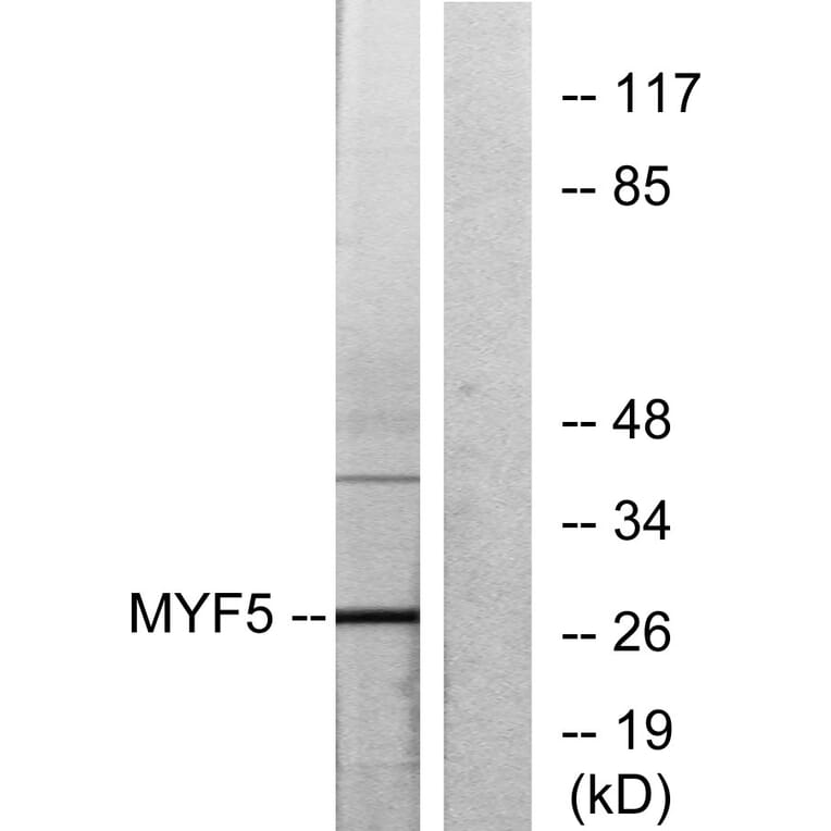 Western Blot - Anti-MYF5 Antibody (C10359) - Antibodies.com