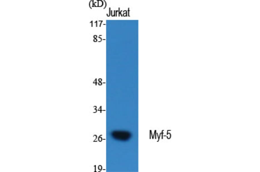 Western Blot - Anti-MYF5 Antibody (C10359) - Antibodies.com