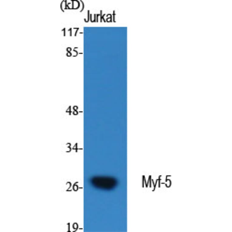Western Blot - Anti-MYF5 Antibody (C10359) - Antibodies.com