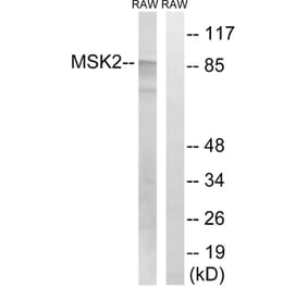 Western Blot - Anti-MSK2 Antibody (B8149) - Antibodies.com
