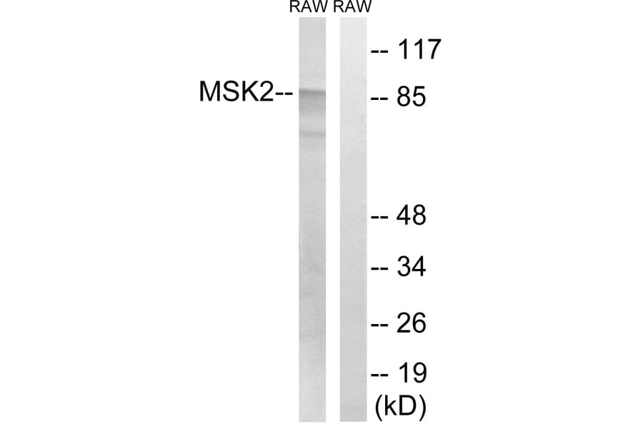 Western Blot - Anti-MSK2 Antibody (B8149) - Antibodies.com