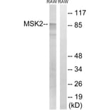 Western Blot - Anti-MSK2 Antibody (B8149) - Antibodies.com