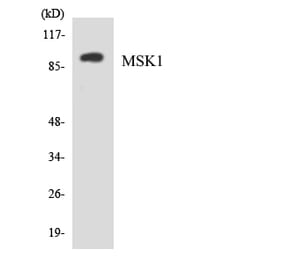 Western Blot - Anti-MSK1 Antibody (R12-3058) - Antibodies.com