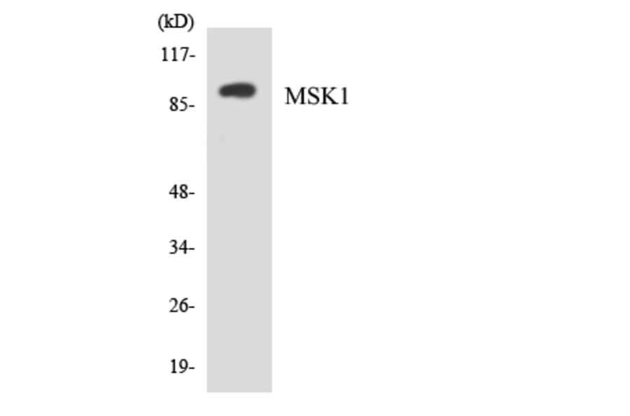 Western Blot - Anti-MSK1 Antibody (R12-3058) - Antibodies.com