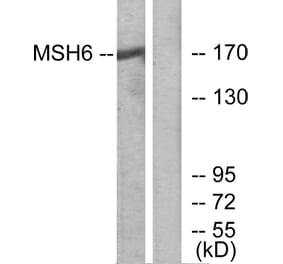 Western Blot - Anti-MSH6 Antibody (C13091) - Antibodies.com