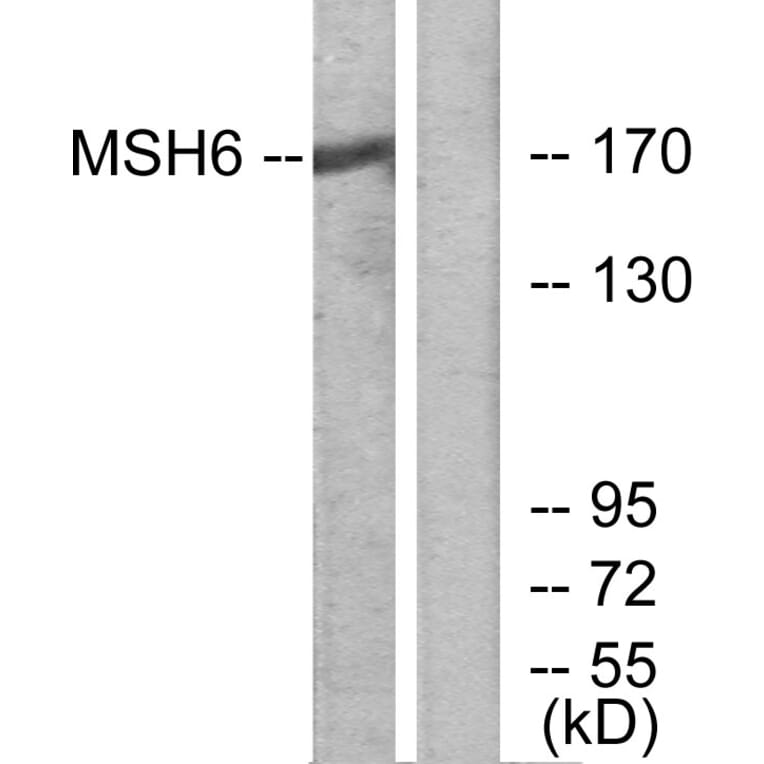 Western Blot - Anti-MSH6 Antibody (C13091) - Antibodies.com
