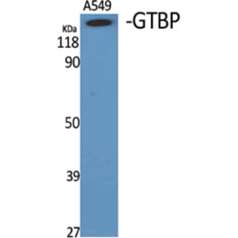 Western Blot - Anti-MSH6 Antibody (C13091) - Antibodies.com