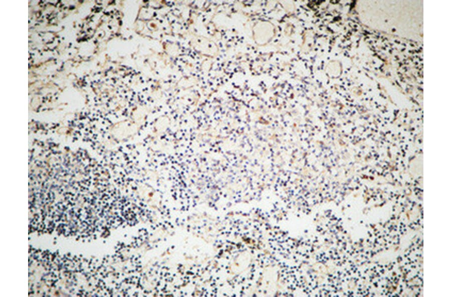 Immunohistochemistry - Anti-MSH6 Antibody (C13091) - Antibodies.com