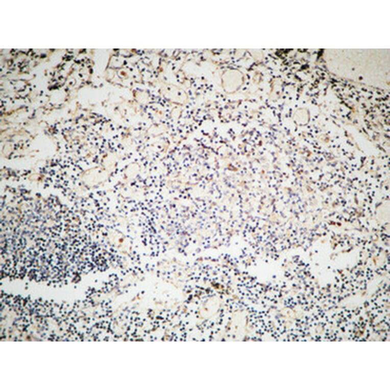 Immunohistochemistry - Anti-MSH6 Antibody (C13091) - Antibodies.com