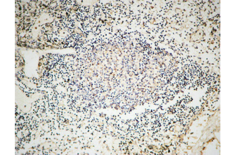 Immunohistochemistry - Anti-MSH6 Antibody (C13091) - Antibodies.com