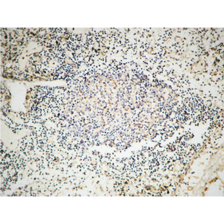 Immunohistochemistry - Anti-MSH6 Antibody (C13091) - Antibodies.com