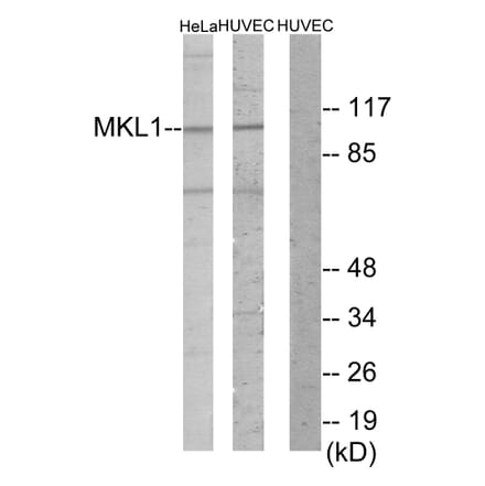 Western Blot - Anti-MKL1 Antibody (C11466) - Antibodies.com