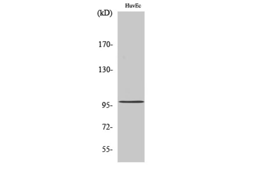Western Blot - Anti-MKL1 Antibody (C11466) - Antibodies.com