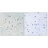 Immunohistochemistry - Anti-MKL1 Antibody (C11466) - Antibodies.com