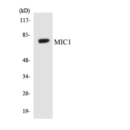 Western Blot - Anti-MIC1 Antibody (R12-3018) - Antibodies.com