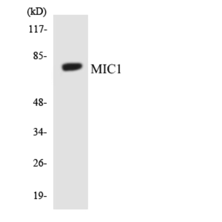Western Blot - Anti-MIC1 Antibody (R12-3018) - Antibodies.com