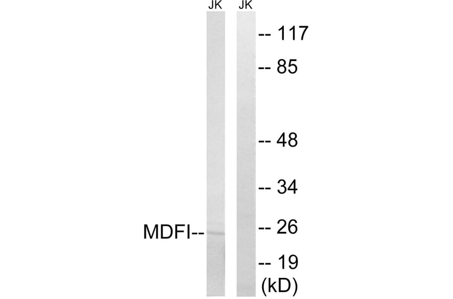 Western Blot - Anti-MDFI Antibody (C16756) - Antibodies.com
