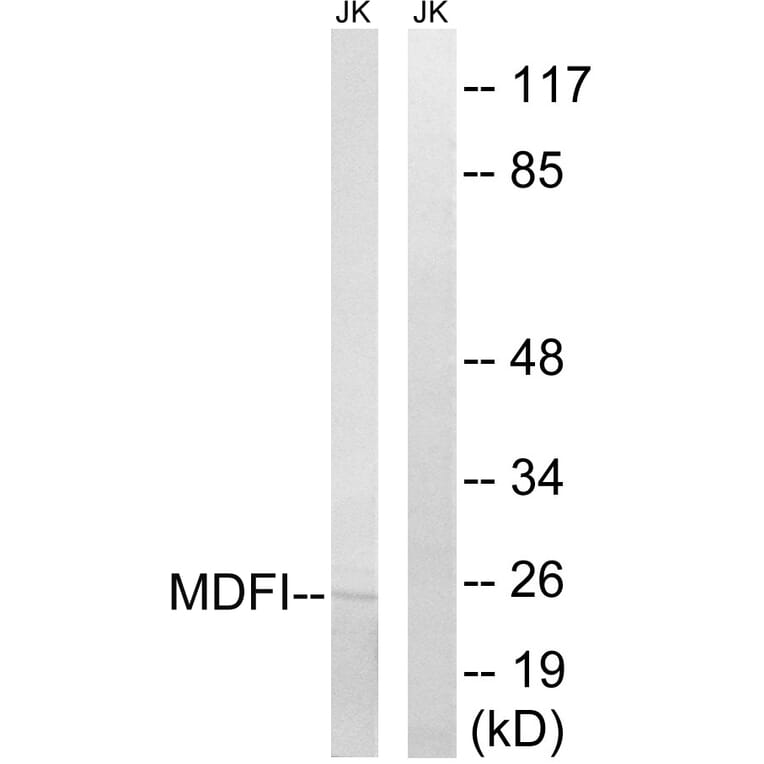 Western Blot - Anti-MDFI Antibody (C16756) - Antibodies.com