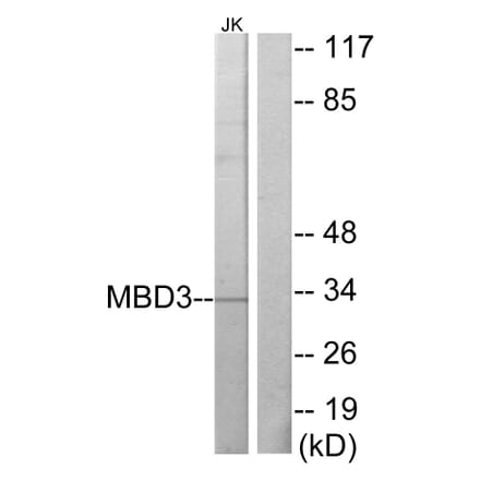 Western Blot - Anti-MBD3 Antibody (C10250) - Antibodies.com