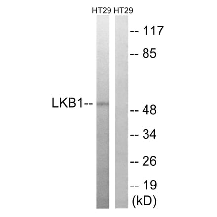 Western Blot - Anti-LKB1 Antibody (B8127) - Antibodies.com