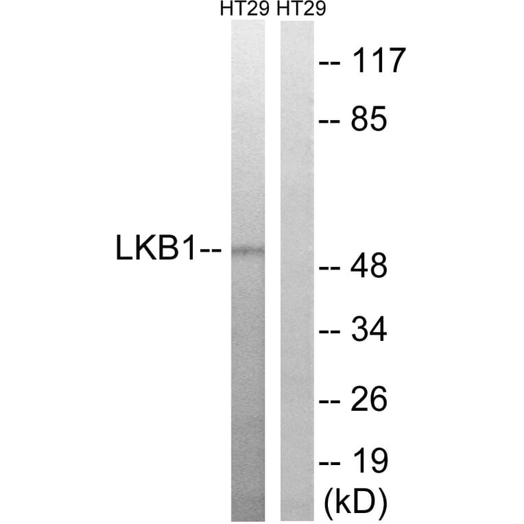 Western Blot - Anti-LKB1 Antibody (B8127) - Antibodies.com
