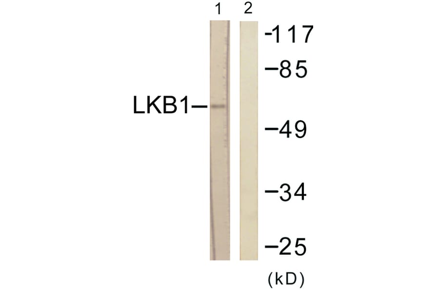 Western Blot - Anti-LKB1 Antibody (B0673) - Antibodies.com
