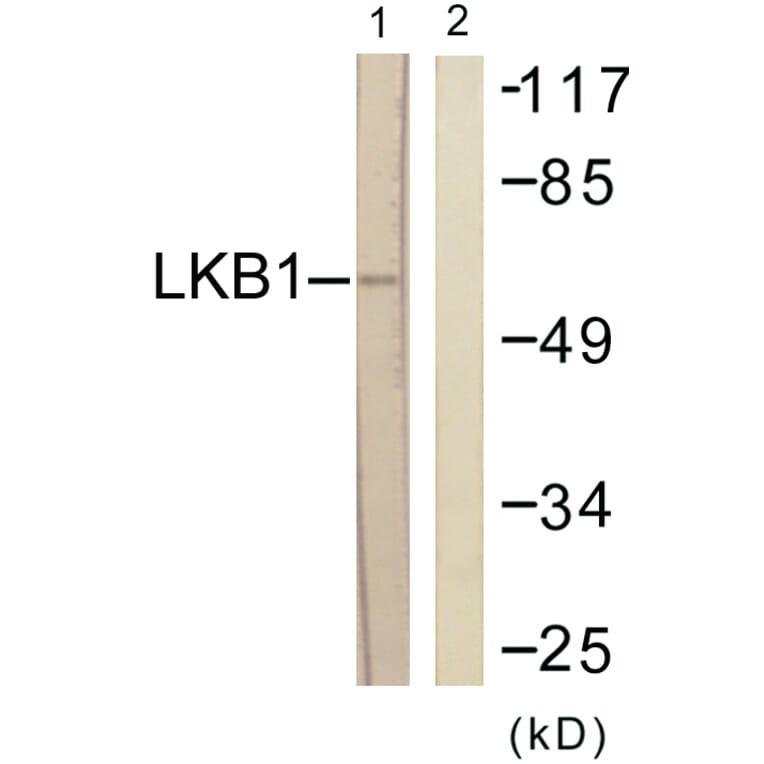 Western Blot - Anti-LKB1 Antibody (B0673) - Antibodies.com