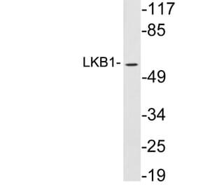 Western Blot - Anti-LKB1 Antibody (R12-2227) - Antibodies.com