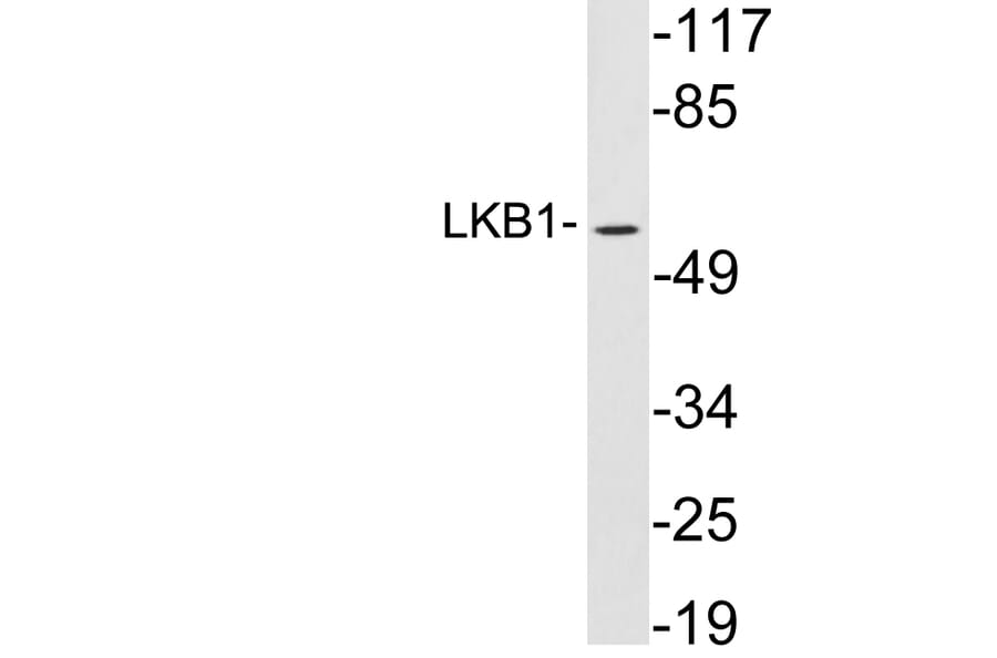 Western Blot - Anti-LKB1 Antibody (R12-2227) - Antibodies.com