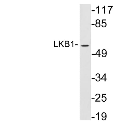 Western Blot - Anti-LKB1 Antibody (R12-2227) - Antibodies.com